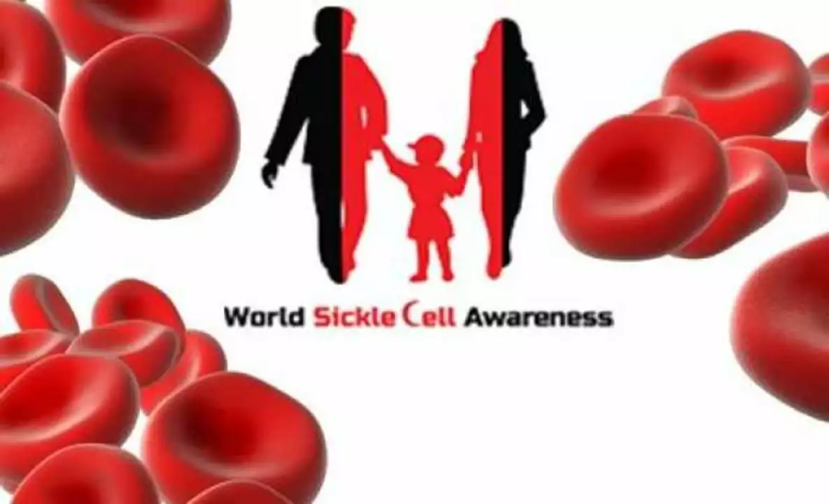 The Role of Diet and Nutrition in Managing Sickle Cell Anemia